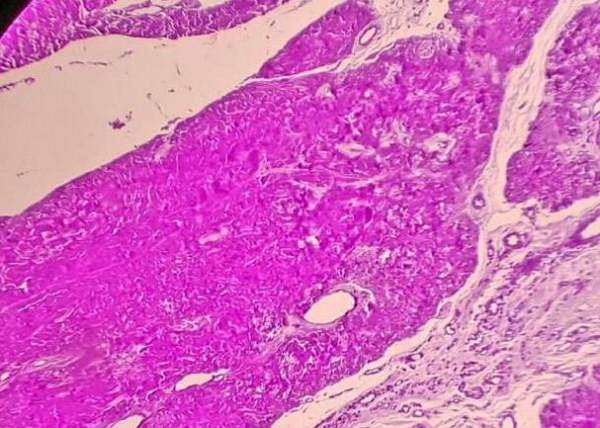 結(jié)晶紫染色