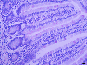 過(guò)碘酸—雪夫染色